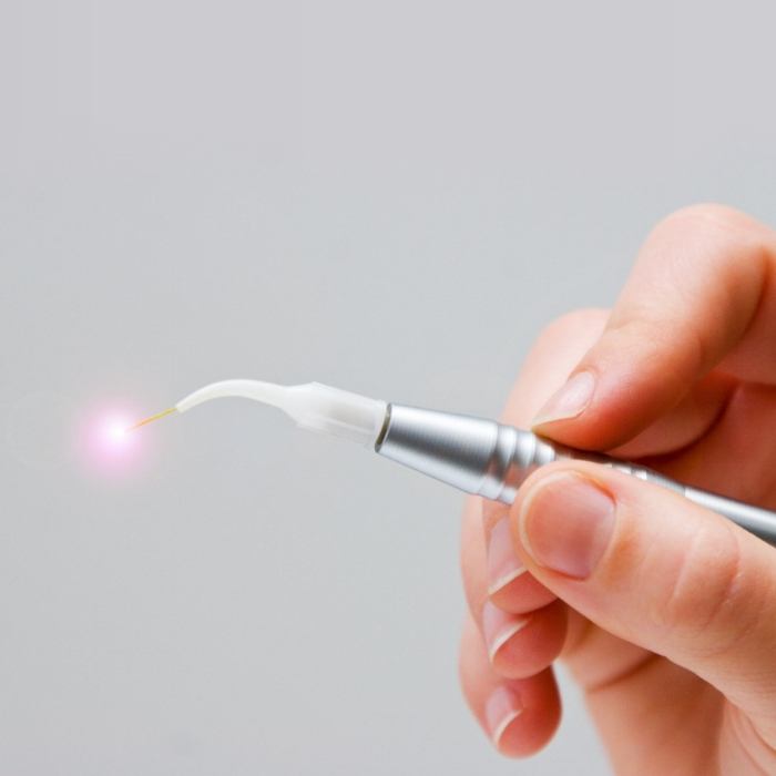 Hand holding small dental laser device
