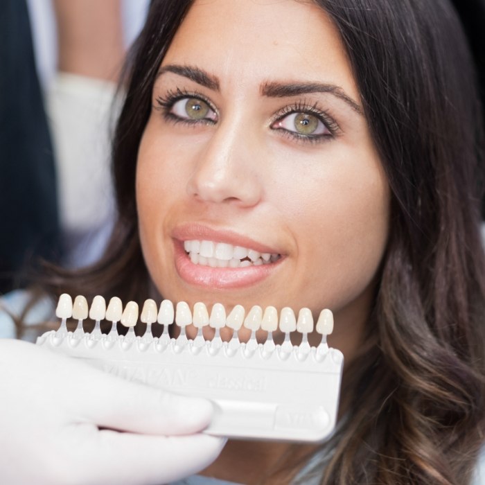 Woman smiling next to shade guide for veneers from cosmetic dentist in Plattsburgh