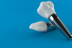 Dental implants on a blue background