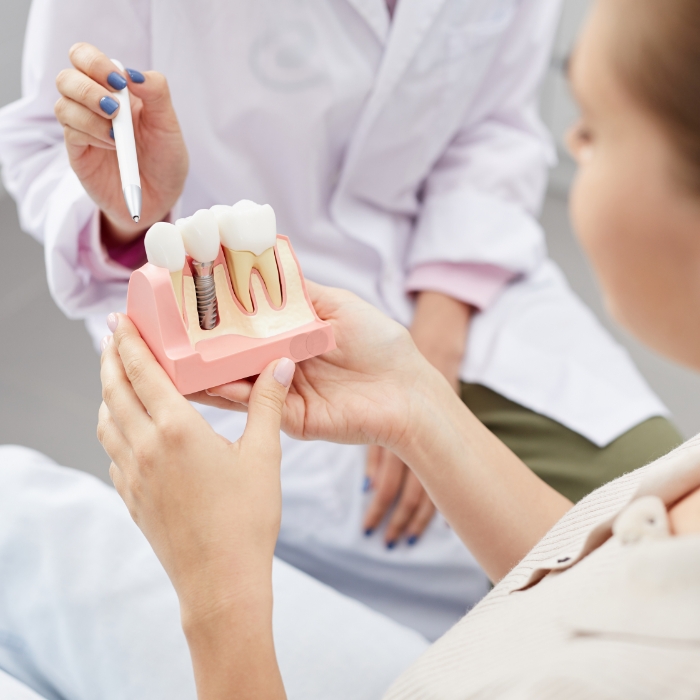 Dentist showing a dental implant model to a patient