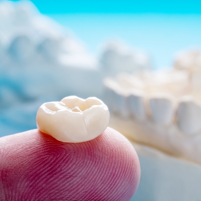 Dental crown resting on a finger